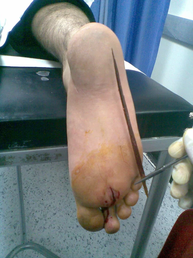 The Legal Aspects Of Foot Photography